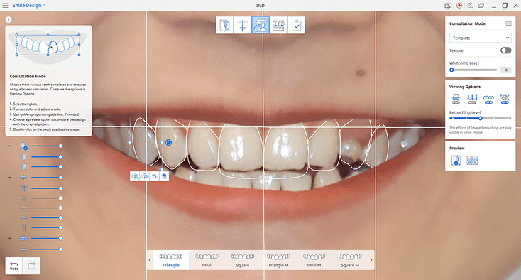 Medit-link-apps-smile-design