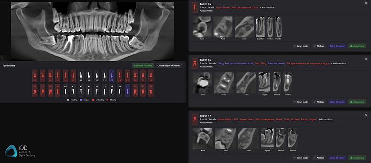 iDD-cbct-report-diagnocat-scan