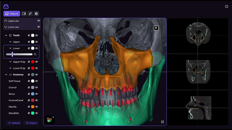 cbct-3d-imaging-idd-institute-of-digital-dentistry-podcast-blog