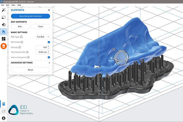 idd-3d-printed-surgical-guides-workflow-slicing-sfotware-preform-formlabs