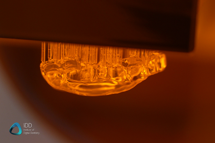 idd-3d-printed-surgical-guides-workflow-freshly-printed-guide-formlabs-platform-3d-printer