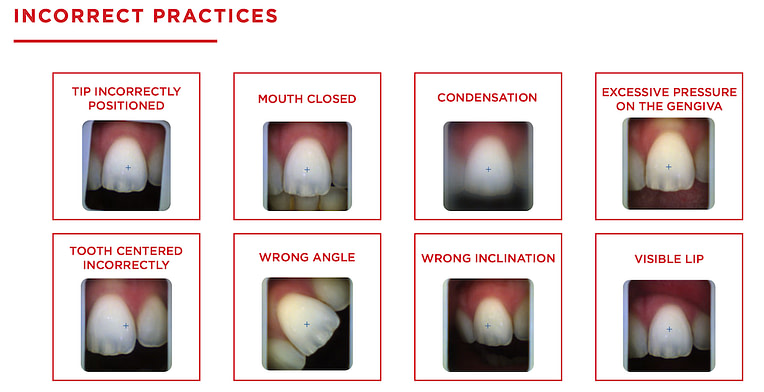 shade_matching_device_dentistry_Borea_iDD2