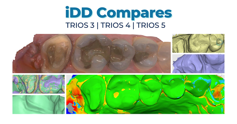TRIOS 3 vs. TRIOS 4 vs. TRIOS 5 - Scanner Review