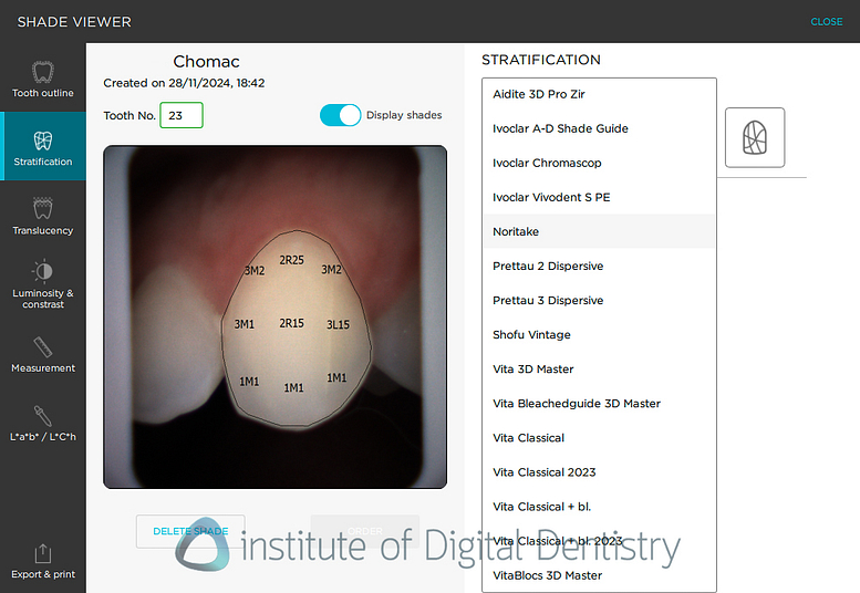 borea_cobra_dental_shade_matching1