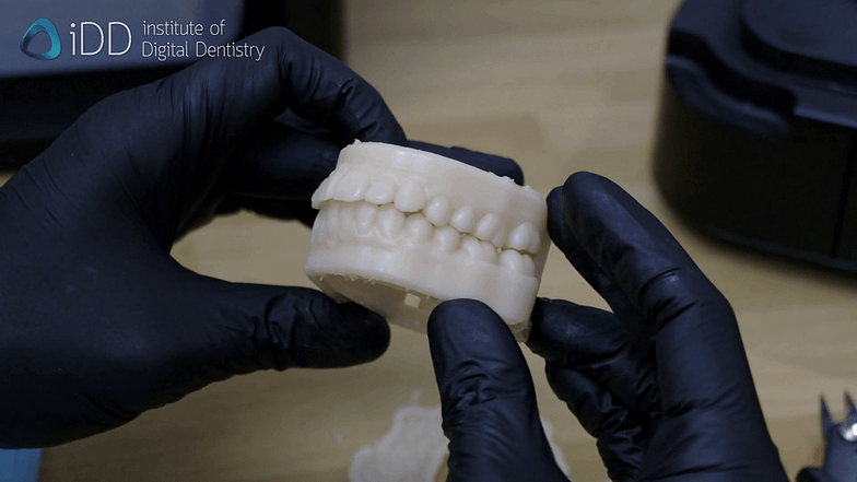 3d-printing-dental-model-idd-finished-occlusal