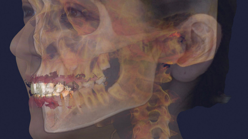 RayFace-Ray-Digital-Avatar