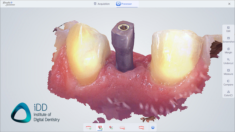 panda_smart_IOS_review_intraoral_scanner_institute_of_digital_dentistry (4)