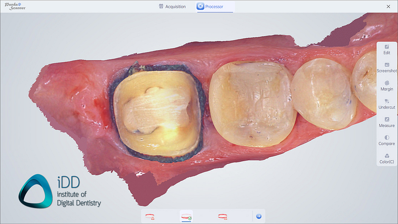 panda_smart_IOS_review_intraoral_scanner_institute_of_digital_dentistry (7)