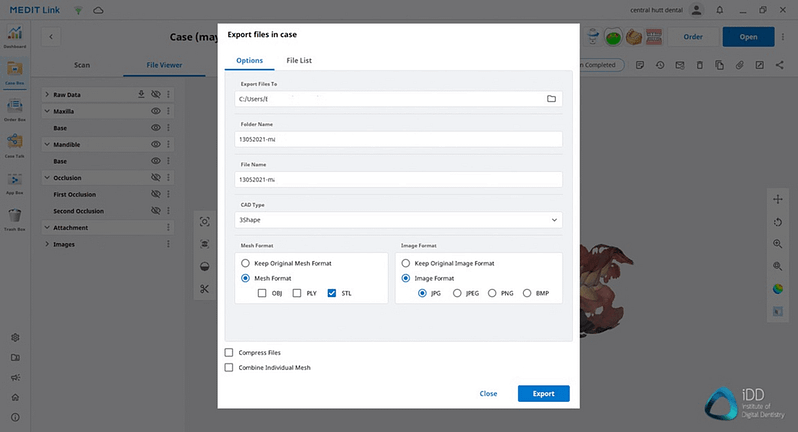 medit-link-software-export-screen-medit-i700-wireless-idd-institute-of-digital-dentistry-14-1