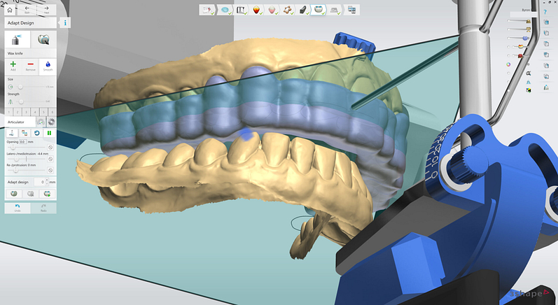 3shape-intraoral-trios-scan-bite-splint-idd-institute-of-digital-dentistry-blog-byron-park-splint-studio-canine-ramp