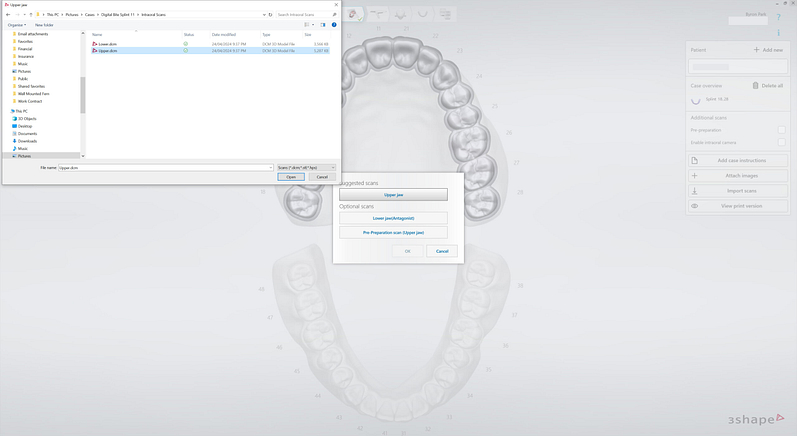 3shape-intraoral-trios-scan-bite-splint-idd-institute-of-digital-dentistry-blog-byron-park-splint-studio-import-scans