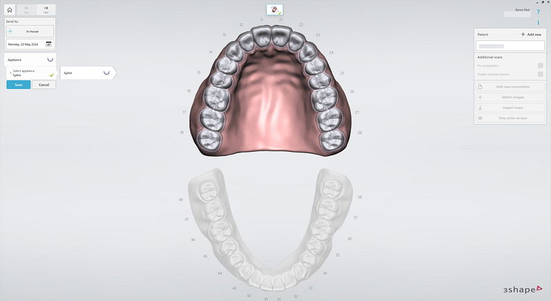 3shape-intraoral-trios-scan-bite-splint-idd-institute-of-digital-dentistry-blog-byron-park-splint-studio-upper-jaw