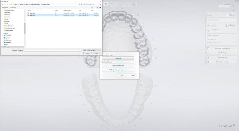 From Scan to Splint: A Step-by-Step 3Shape TRIOS Case Study - Institute ...