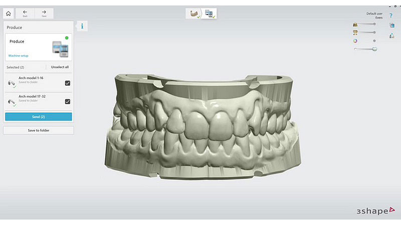 3shape-trios-5-intraoral-scanner-review-model-builder-produce-app-software-idd-digital-dentistry
