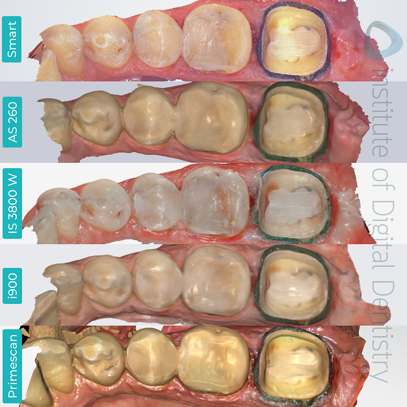 panda-smart-alliedstar-as260-dexis-is-3800-w-medit-i900-cerec-primescan-dentsply-sirona-idd-compares-institute-of-digital-dentistry-blog-native-software-color-scans