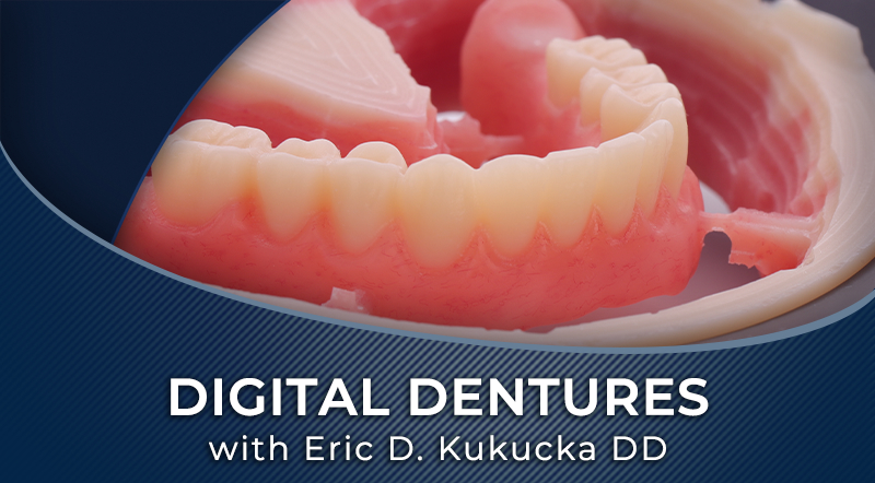 idd-digital-dentures-workflow-course-thumbnail-eric-d-kukuca