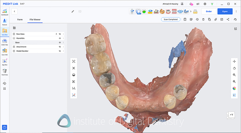 medit_i900_Classic_software_review1