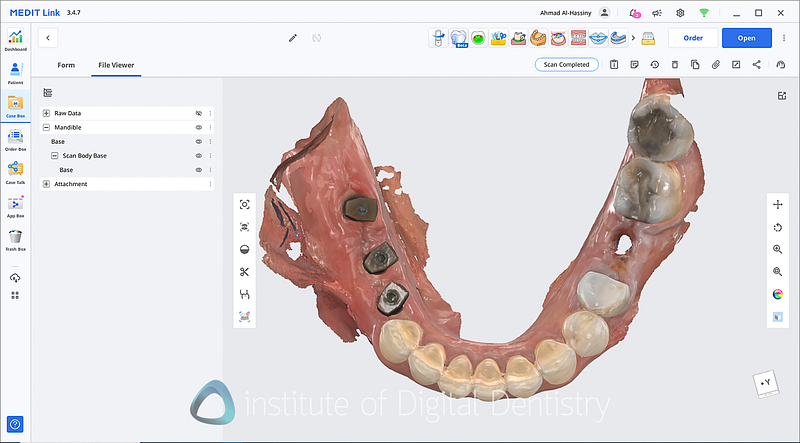 medit_i900_Classic_software_review8