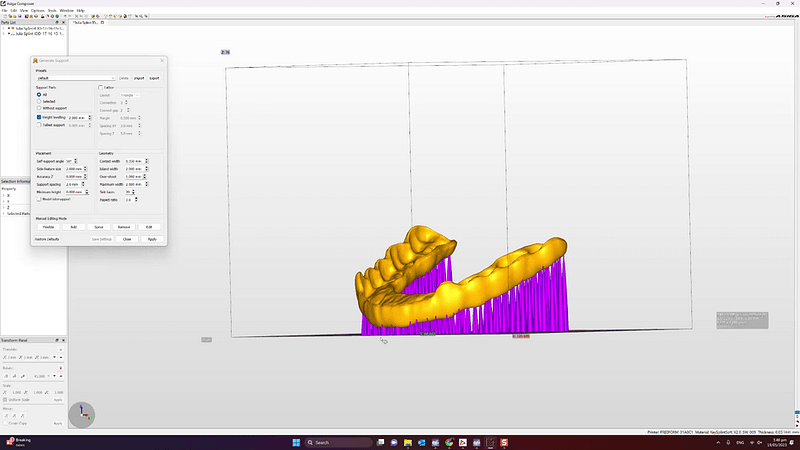 3d-print-dental-splints-nightguards-idd-splint-printing-software-45-degree-angle