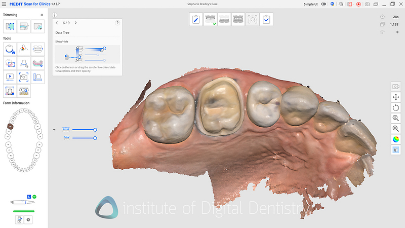 medit_i900_Classic_software_review19