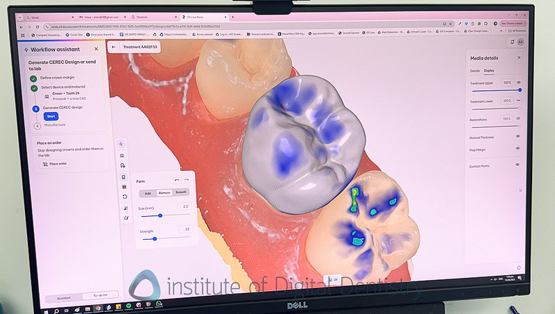 CEREC_DS_CORE