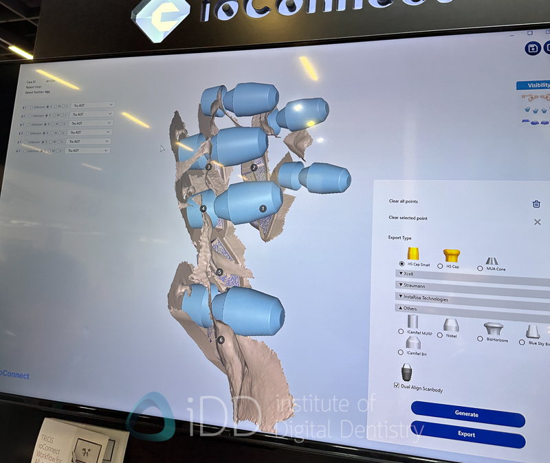 truabutment_IDS_2025
