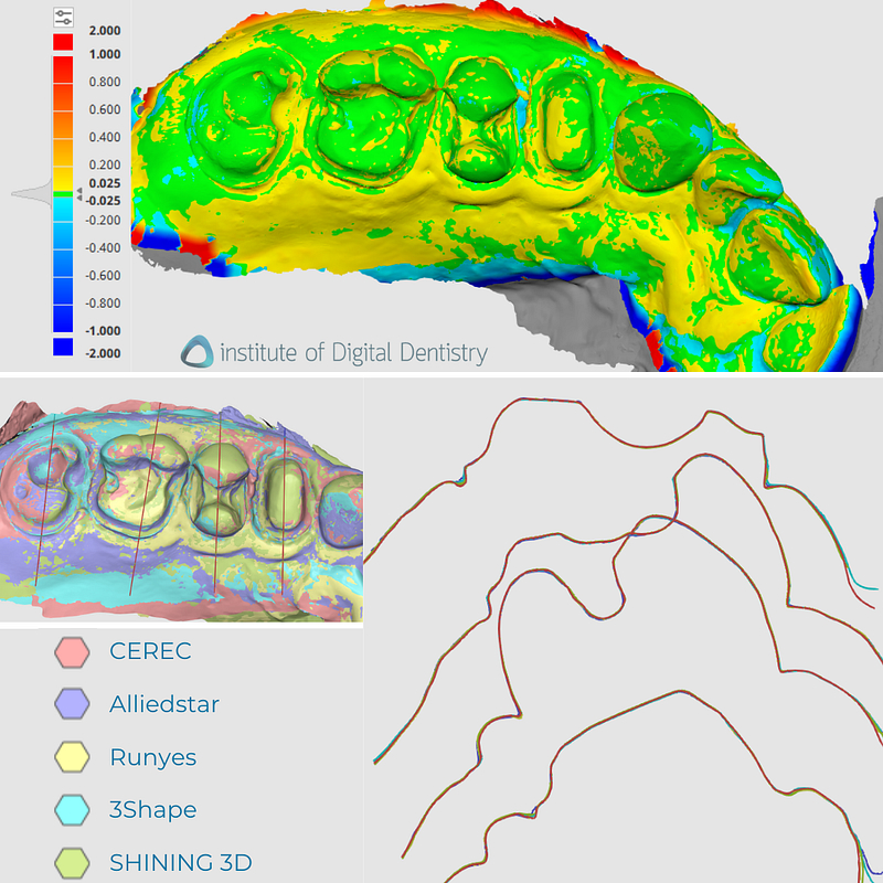 idd-compares-alliedstar-as200e-shining-3d-aoralscan3-dentsply-sirona-cerec-primescan-runyes-3ds-3-3shape-trios5-intraoral-scanner-deviation-map-accuracy-sectional-view-scans