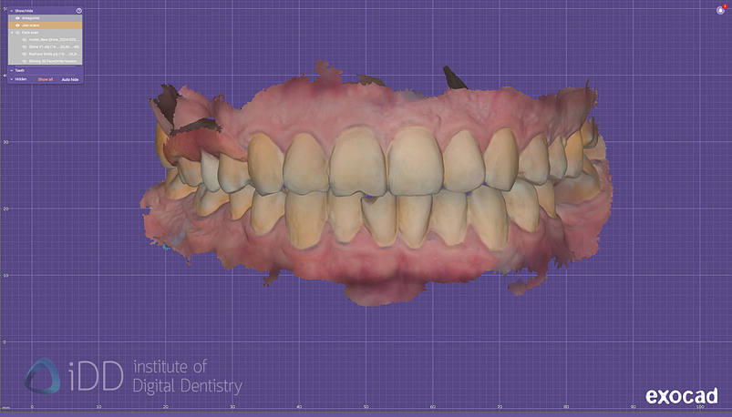 face_scanner_review_dentistry_iDD15