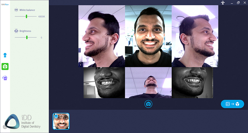 rayface face scanner software institute of digital dentistry (10)