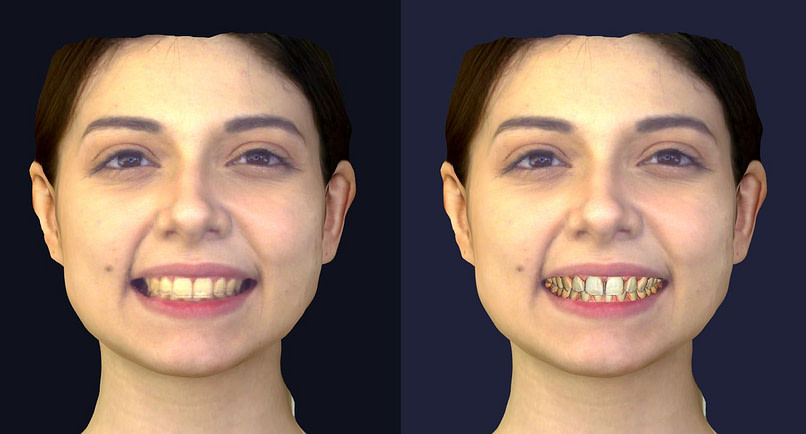 rayface dental facial scanner