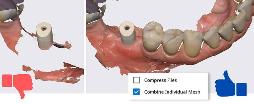 implant-scan-with-trios-medit-cerec-institute-of-digital-dentsitry (1)