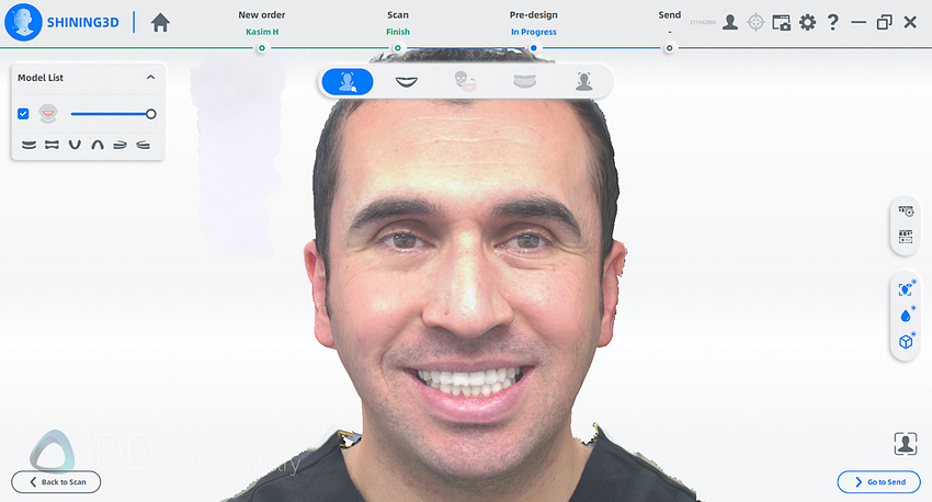 qlone_dental_app_face_scanning_Ray_metismile30