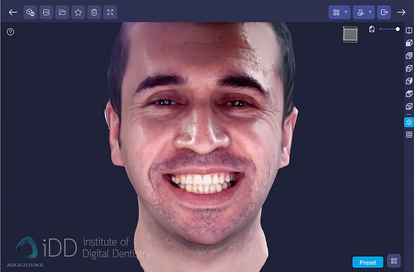 qlone_dental_app_face_scanning_Ray_metismile18