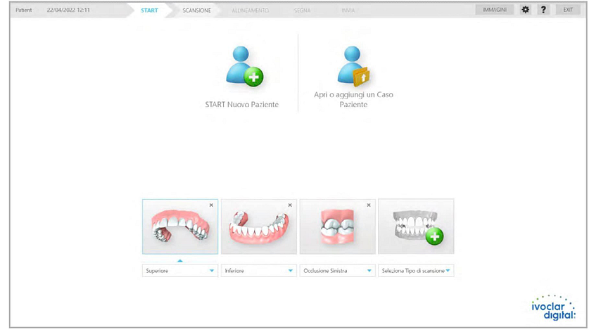 VivaScan by Ivoclar intraoral scanner blog image 7