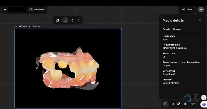 dentsply-sirona-primescan-2-intraoral-scanner-launch-september-2024-idd-institute-of-digital-dentistry-blog-ds-core-canvas-scan