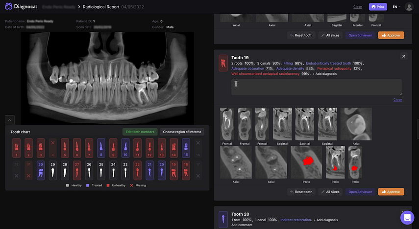diagnocat-ai-software-radiology-report-user-interface-idd-institute-of-digital-dentistry-podcast-blog