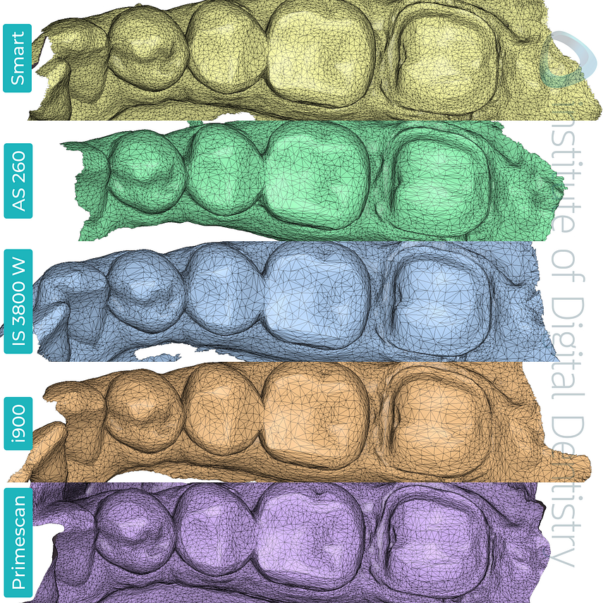 panda-smart-alliedstar-as260-dexis-is-3800-w-medit-i900-cerec-primescan-dentsply-sirona-idd-compares-institute-of-digital-dentistry-blog-medit-design-software-app-tessellation-mesh-density-scan