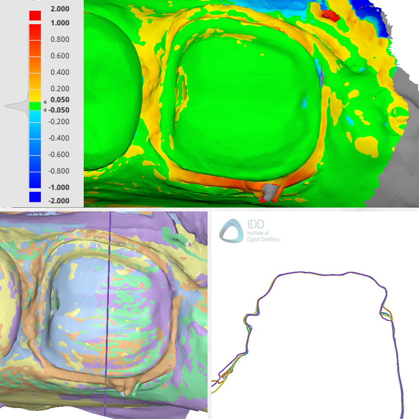panda-smart-alliedstar-as260-dexis-is-3800-w-medit-i900-cerec-primescan-dentsply-sirona-idd-compares-institute-of-digital-dentistry-blog-medit-design-software-app-deviation-accuracy-alignment-scan-individual