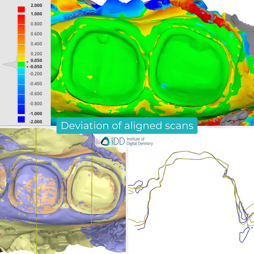 medit-i900-cerec-omnicam-cerec-primescan-dentsply-sirona-idd-compares-institute-of-digital-dentistry-blog-medit-design-software-app-deviation-alignment-accuracy-scan