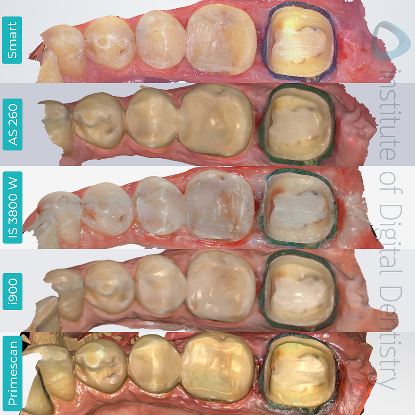 panda-smart-alliedstar-as260-dexis-is-3800-w-medit-i900-cerec-primescan-dentsply-sirona-idd-compares-institute-of-digital-dentistry-blog-native-software-color-scans