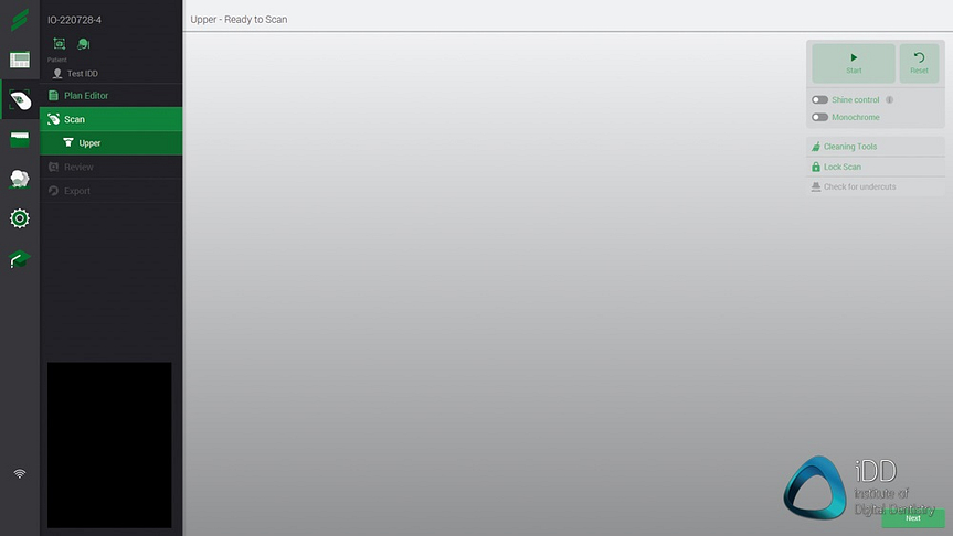 straumann virtuo vivo intraoral scanner review institute of digital dentistry (37)