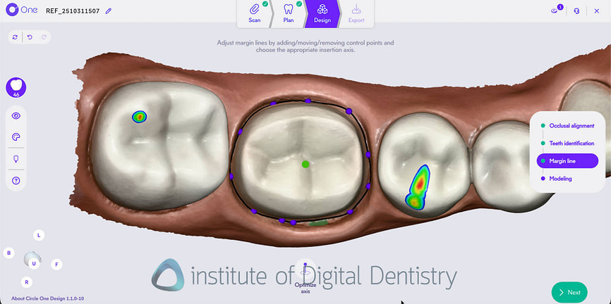 CAD Software in Dentistry - How Everything is Going to the Cloud
