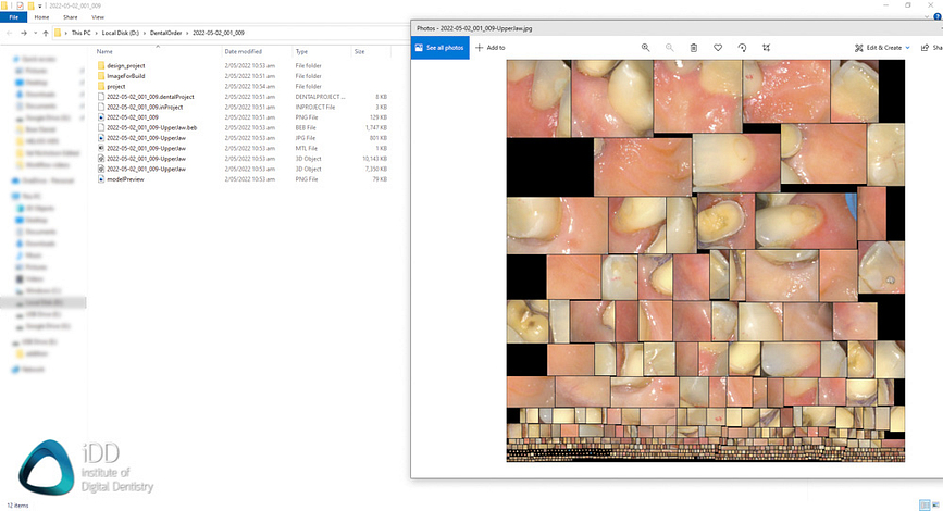 Shining_3D_Aoralscan_3_Review_cost_institute_of_digital_dentistry_ai (89)