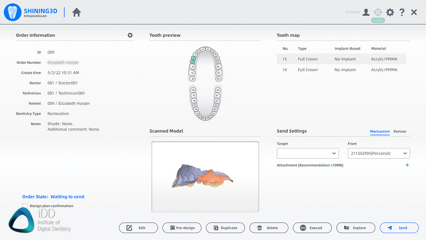 Shining_3D_Aoralscan_3_Review_cost_institute_of_digital_dentistry_ai (88)
