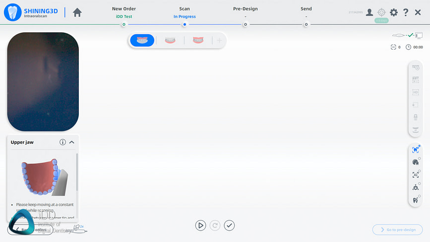 Shining_3D_Aoralscan_3_Review_cost_institute_of_digital_dentistry_ai (66)