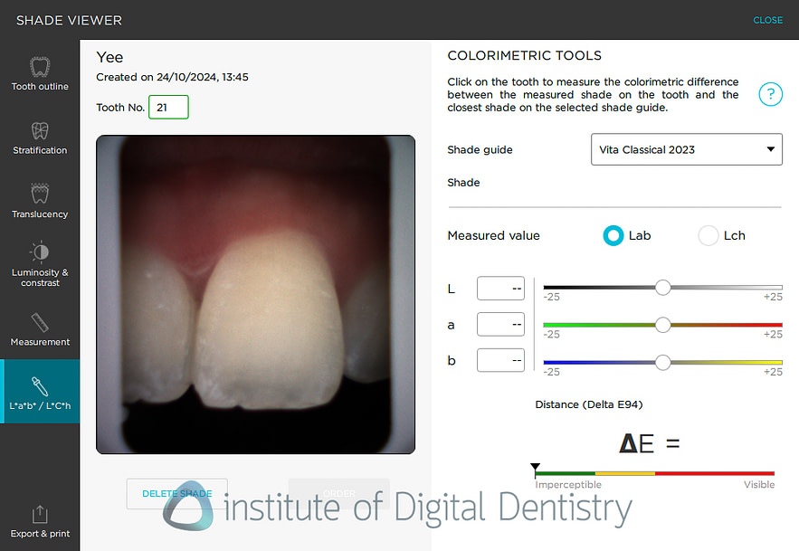 borea_cobra_smart_shade_digital_dentistry_iDD1