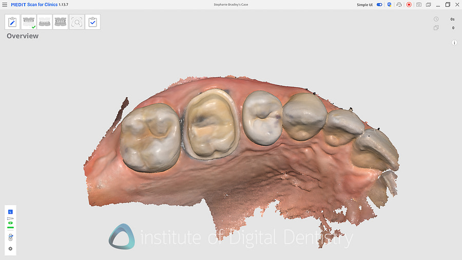 medit_i900_Classic_software_review20
