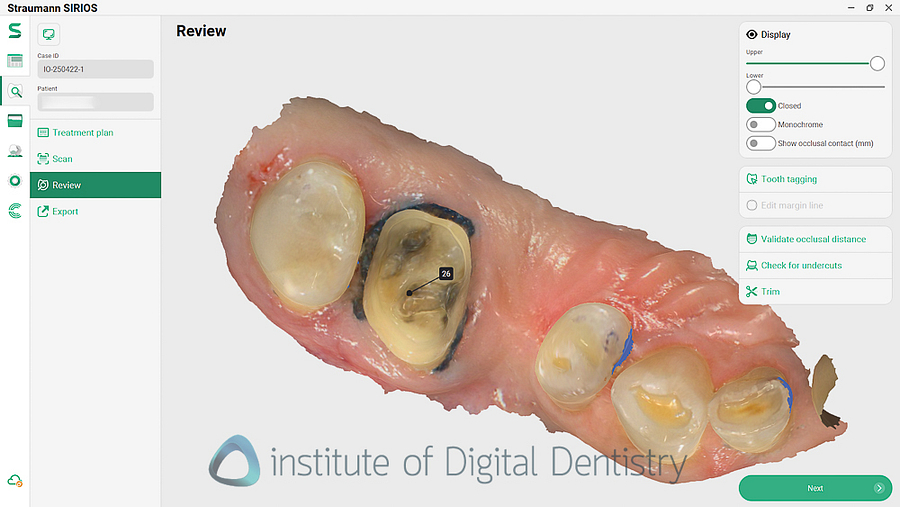 STRAUMANN_SIRIOS_REVIEW_IDD9