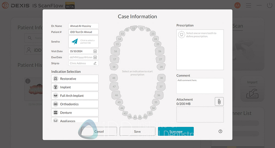 dexis_3800_wireless_intraoral_scanner_review_institute_of_Digital_dentistry28