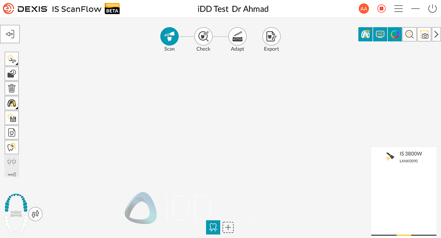 dexis_3800_wireless_intraoral_scanner_review_institute_of_Digital_dentistry16